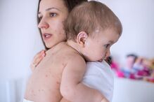 Robin Nandy, Unicef, Organização Mundial de Saúde, OMS, sarampo, mortes, República Democrática do Congo, Índia, Indonésia, saúde