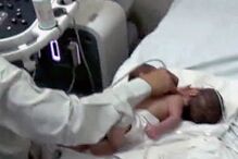 16-11-2016_16_55_45 PAY-Parasitic-twins (3).jpg