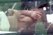 16-11-2016_16_55_46 PAY-Parasitic-twins (2).jpg