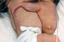 16-11-2016_16_55_47 PAY-Parasitic-twins (1).jpg