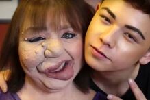 jovem, travesti, doença, síndroma rara, EUA, maquilhagem, Matthew Tronconi, Joanne Tronconi