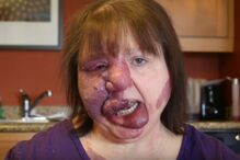 jovem, travesti, doença, síndroma rara, EUA, maquilhagem, Matthew Tronconi, Joanne Tronconi