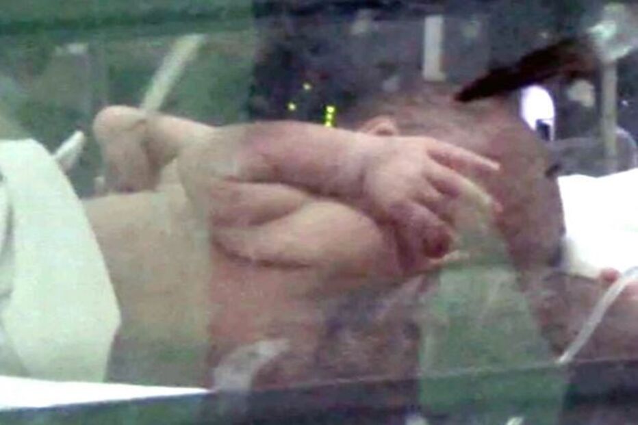 16-11-2016_16_55_46 PAY-Parasitic-twins (2).jpg