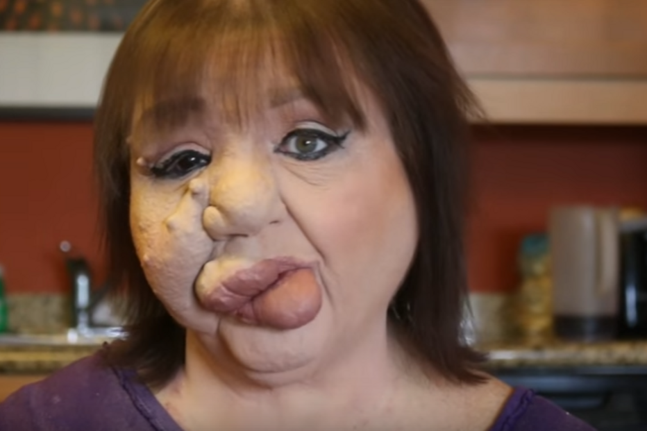 jovem, travesti, doença, síndroma rara, EUA, maquilhagem, Matthew Tronconi, Joanne Tronconi