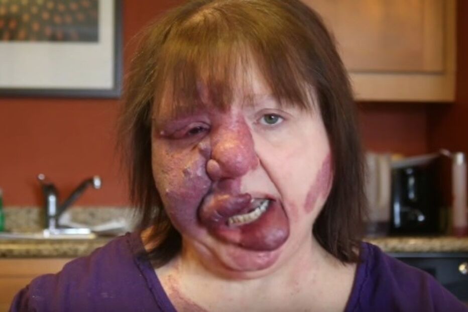 jovem, travesti, doença, síndroma rara, EUA, maquilhagem, Matthew Tronconi, Joanne Tronconi