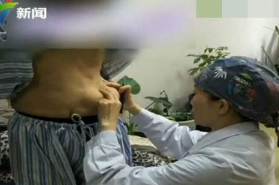 mulher, gel tóxico, seios