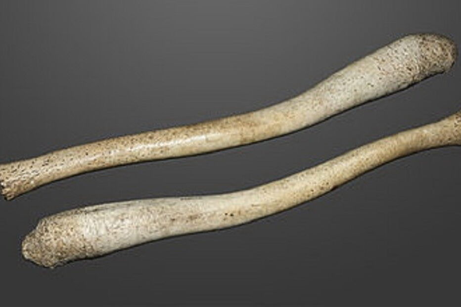 Pénis, ser humano, osso, mamíferos, baculum