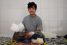 homem-árvore, Abul Bajandar, cirurgias, hospital, cura, Bangladesh, epidermodisplasia verruciforme