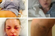 Christy Mack foi violentamente agredida pelo namorado, o lutador de MMA War Machine