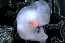 Instituto Salk para os Estudos Biológicos, células humanas, embriões de porcos, criação, órgãos humanos, ciência e tecnologia, saúde