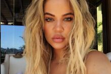 Khloé Kardashian, lábios, botox, crítica