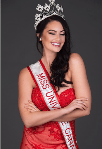 Miss Canadá fala novamente sobre críticas a suas curvas: Temos que  celebrar a diversidade - Quem