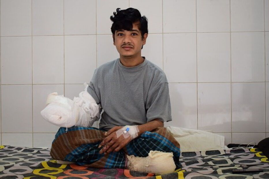 homem-árvore, Abul Bajandar, cirurgias, hospital, cura, Bangladesh, epidermodisplasia verruciforme