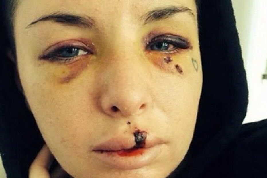 Christy Mack foi violentamente agredida pelo namorado, o lutador de MMA War Machine