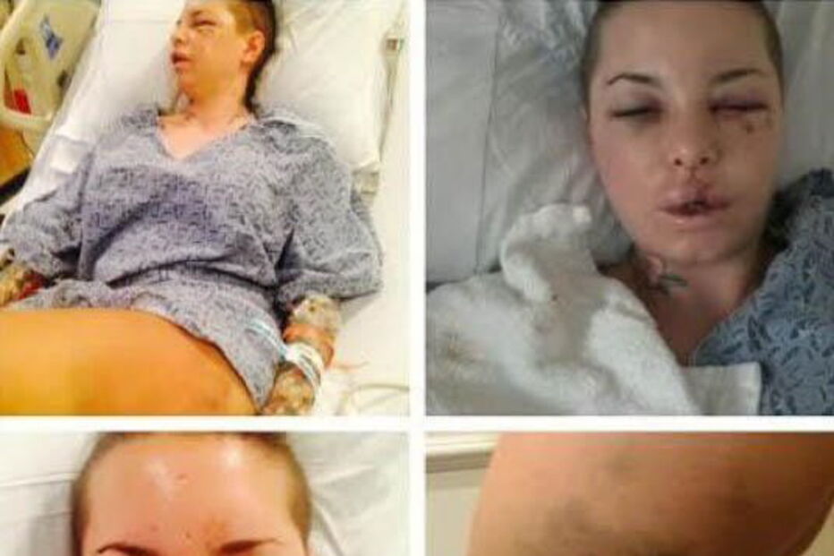 Christy Mack foi violentamente agredida pelo namorado, o lutador de MMA War Machine