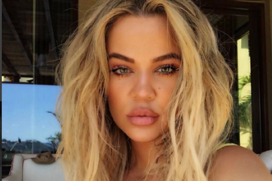 Khloé Kardashian, lábios, botox, crítica