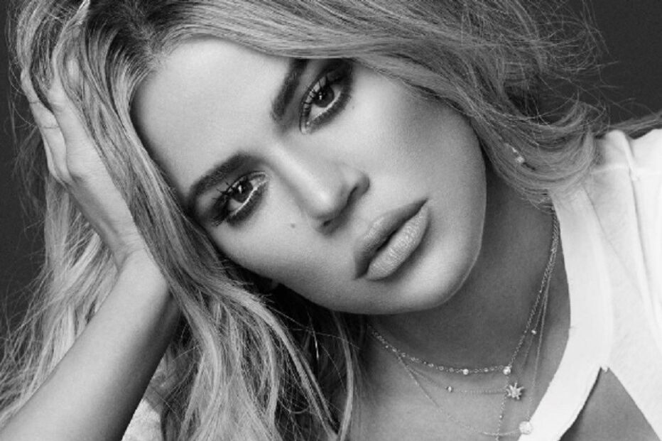 Khloé Kardashian, lábios, botox, crítica