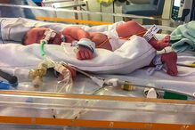 A pequena Evelyn acabou por morrer no hospital, mas a mãe não quis abdicar dos últimos momentos ao lado da filha