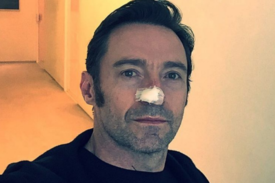 Hugh Jackman