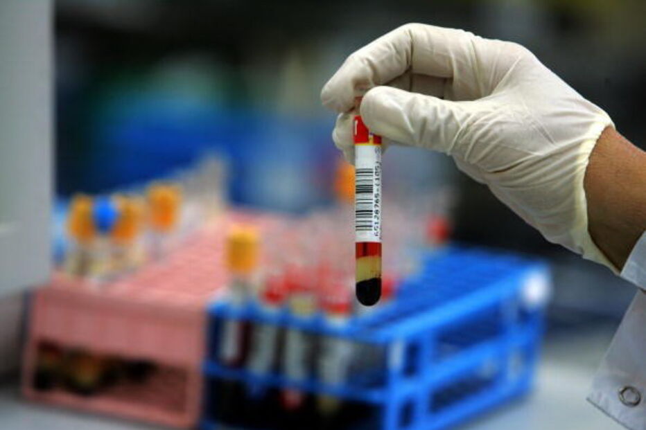 Documento classifica homossexuais como um grupo com 'prevalência de VIH'