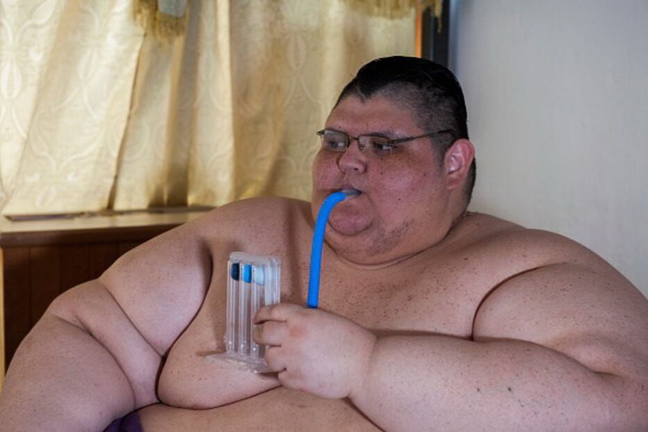 Juan Pedro Franco é o homem mais obeso do mundo 