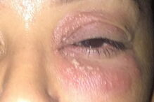 Imagens das agressões sofridas por Mel B