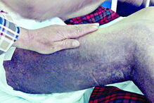 José Martins apresentava nódoas negras evidentes nas pernas e nos braços 