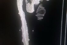 Roberto Esquivel Cabrera, de 48 anos, tem um pénis de 48 centímetros