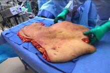 Lupe perdeu mais de 220 quilos