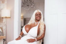 Martina Big é alemã e conta com o apoio do namorado nas cirurgias estéticas que já fez