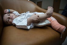 Menino iraquiano que nasceu com oito membros é operado na Índia