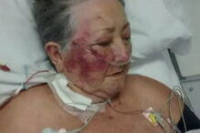 Idosa espancada por enfermeiro em hospital 