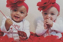 Kalani e Jarani Dean, as gémeas que nasceram com cores de pele diferentes, celebram esta quarta-feira, o primeiro aniversário