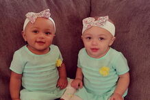 Kalani e Jarani Dean, as gémeas que nasceram com cores de pele diferentes, celebram esta quarta-feira, o primeiro aniversário