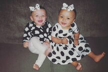 Kalani e Jarani Dean, as gémeas que nasceram com cores de pele diferentes, celebram esta quarta-feira, o primeiro aniversário