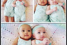 Kalani e Jarani Dean, as gémeas que nasceram com cores de pele diferentes, celebram esta quarta-feira, o primeiro aniversário