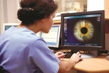 Ao estudar a íris do indivíduo, o especialista pode detetar predisposição genética para determinadas doenças    