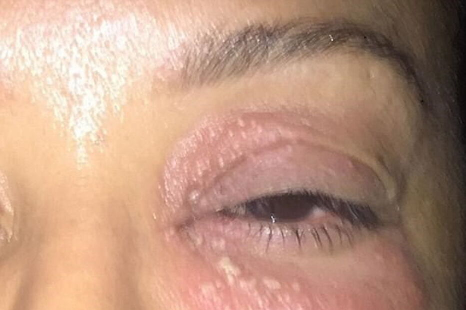 Imagens das agressões sofridas por Mel B