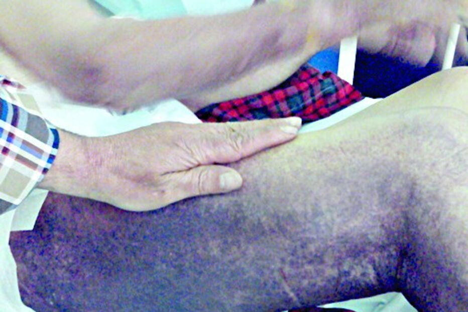 José Martins apresentava nódoas negras evidentes nas pernas e nos braços 