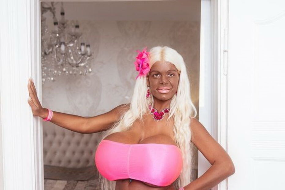 Martina Big, que tem os maiores seios da Europa, submeteu-se a um procedimento para escurecer a pele