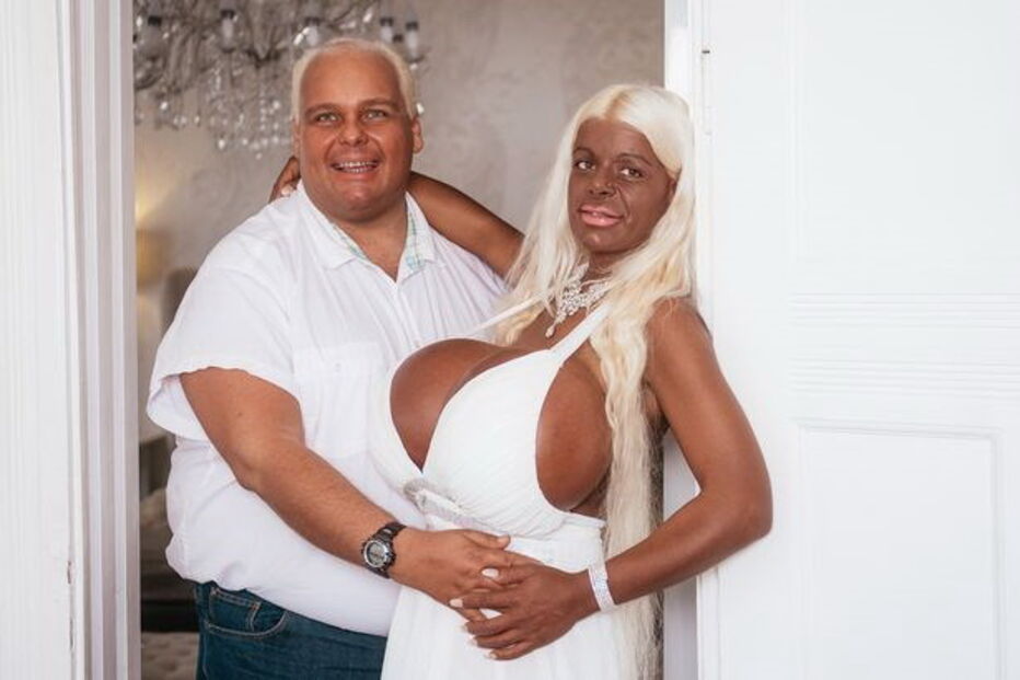 Martina Big é alemã e conta com o apoio do namorado nas cirurgias estéticas que já fez