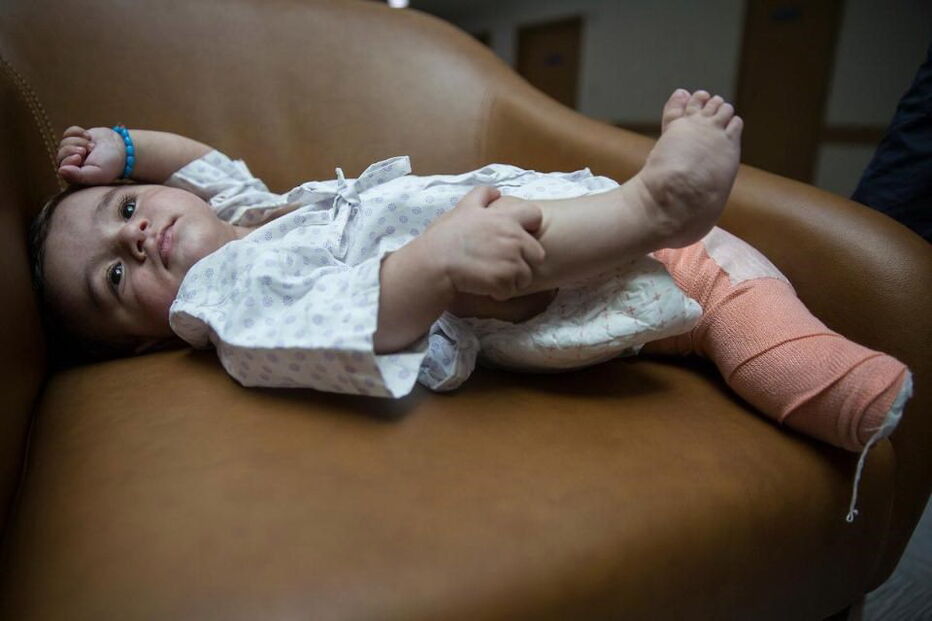 Menino iraquiano que nasceu com oito membros é operado na Índia