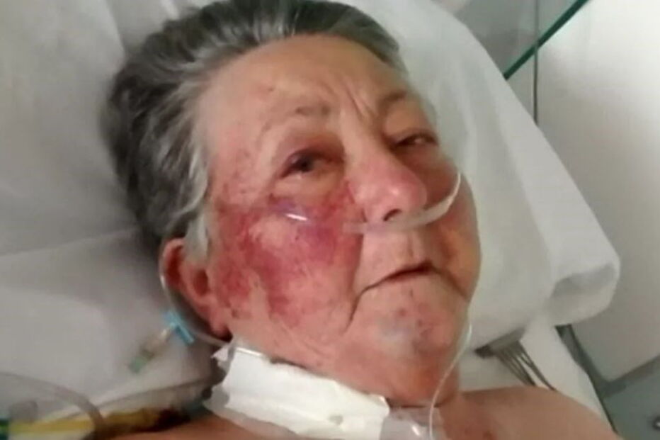 Idosa espancada por enfermeiro em hospital 