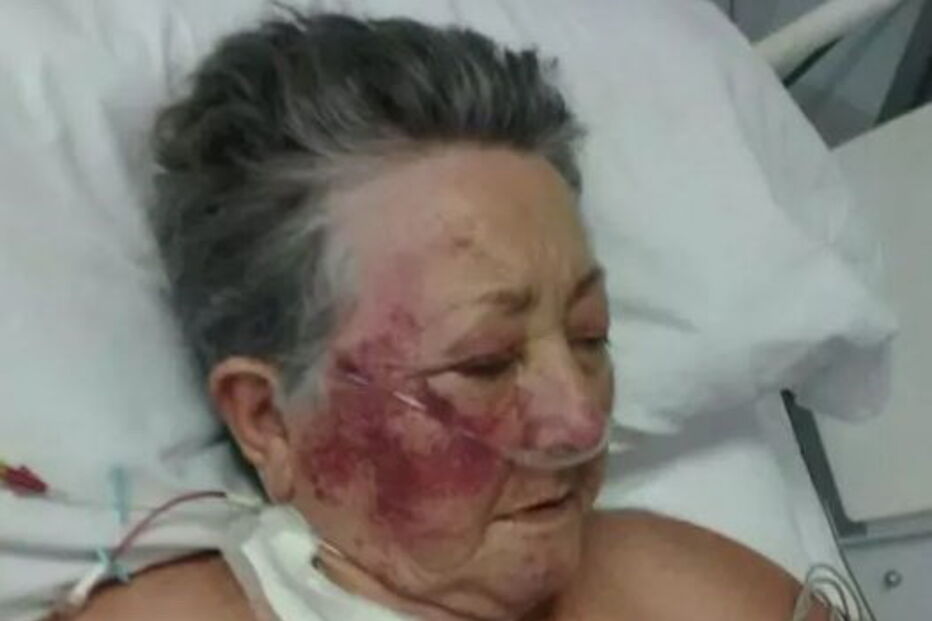 Idosa espancada por enfermeiro em hospital 