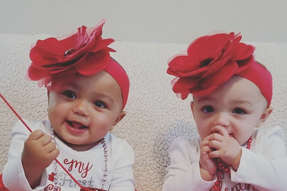 Kalani e Jarani Dean, as gémeas que nasceram com cores de pele diferentes, celebram esta quarta-feira, o primeiro aniversário