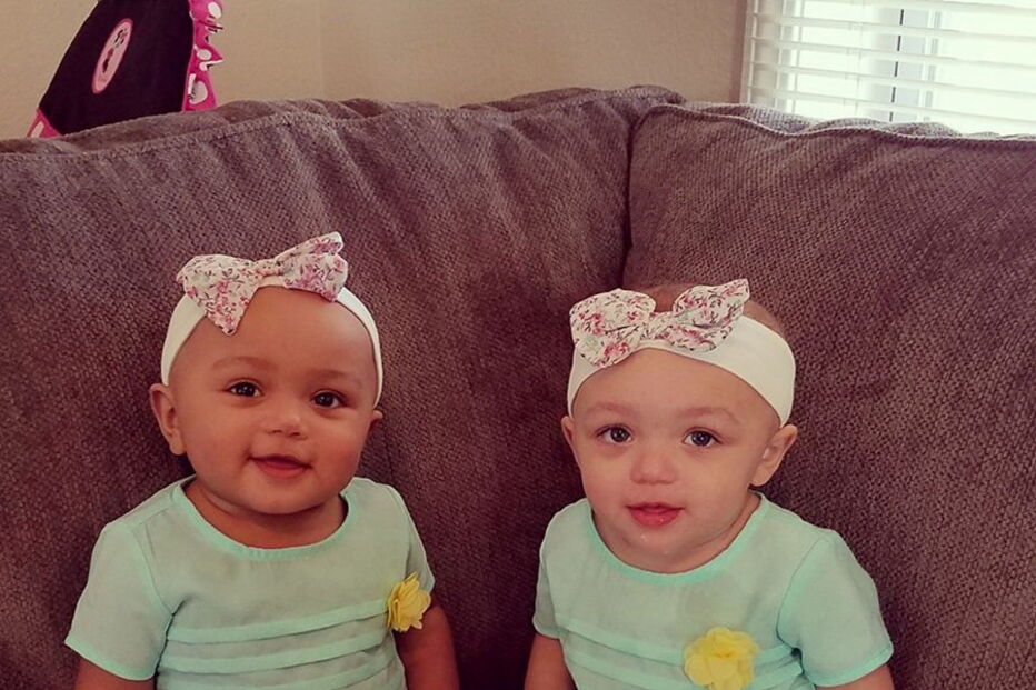 Kalani e Jarani Dean, as gémeas que nasceram com cores de pele diferentes, celebram esta quarta-feira, o primeiro aniversário