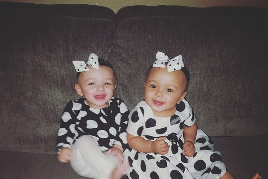Kalani e Jarani Dean, as gémeas que nasceram com cores de pele diferentes, celebram esta quarta-feira, o primeiro aniversário