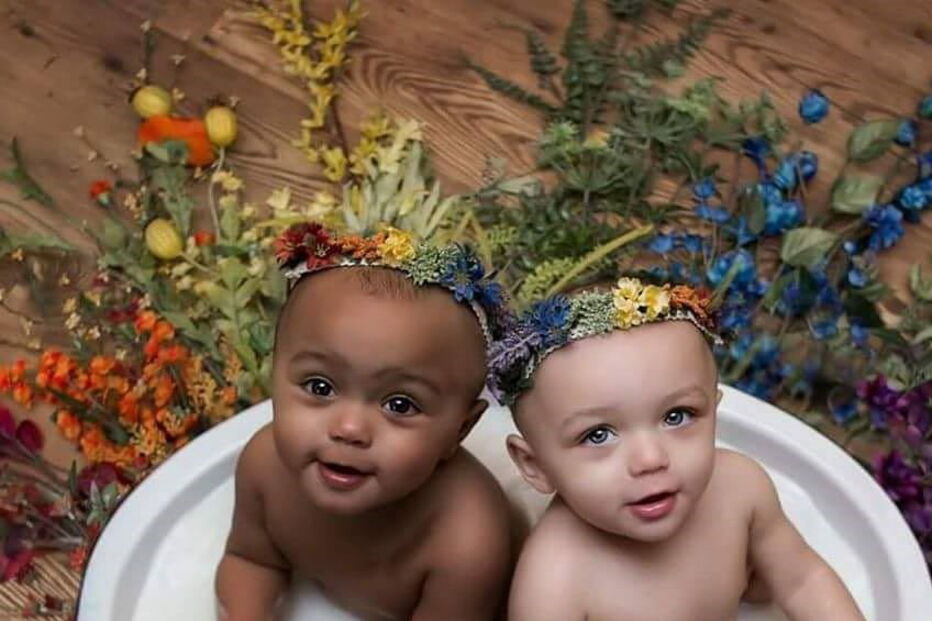 Kalani e Jarani Dean, as gémeas que nasceram com cores de pele diferentes, celebram esta quarta-feira, o primeiro aniversário