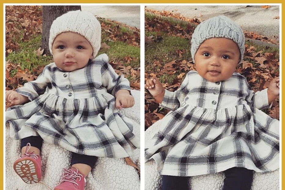 Kalani e Jarani Dean, as gémeas que nasceram com cores de pele diferentes, celebram esta quarta-feira, o primeiro aniversário