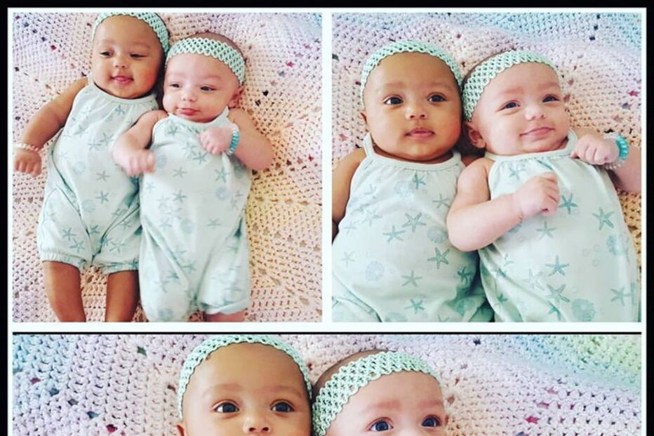 Kalani e Jarani Dean, as gémeas que nasceram com cores de pele diferentes, celebram esta quarta-feira, o primeiro aniversário